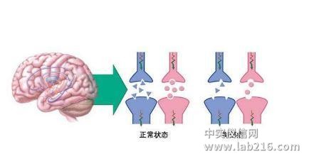 杨森公司抗抑郁症新药艾氯胺酮(esketamine)获批上市