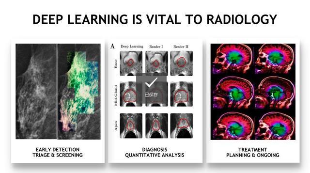 从基因诊断到医疗影像分析，11个案例帮你读懂深度学习的应用