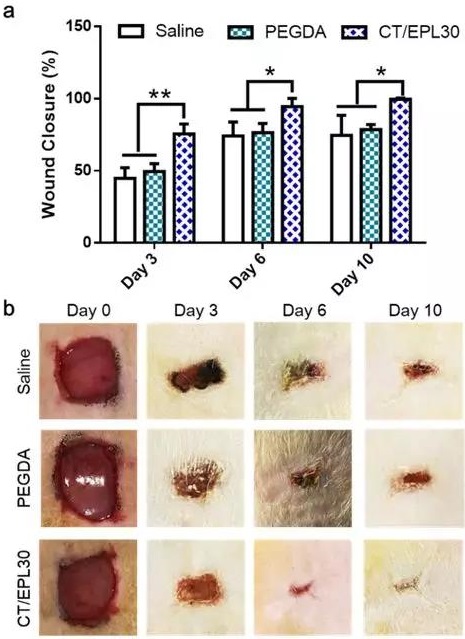 伤口愈合过程中saline，PEGDA水凝胶和CT/EPL30水凝胶组的伤口闭合率