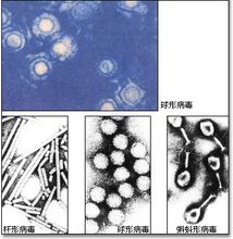 电子显微镜下的病毒