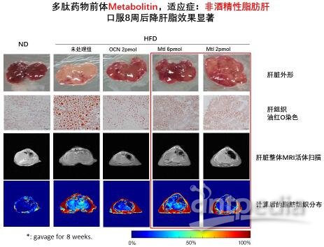 me<em></em>tabolitin降肝脂的效果