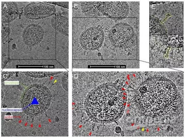 SARS-CoV-2的Cryo-EM结果